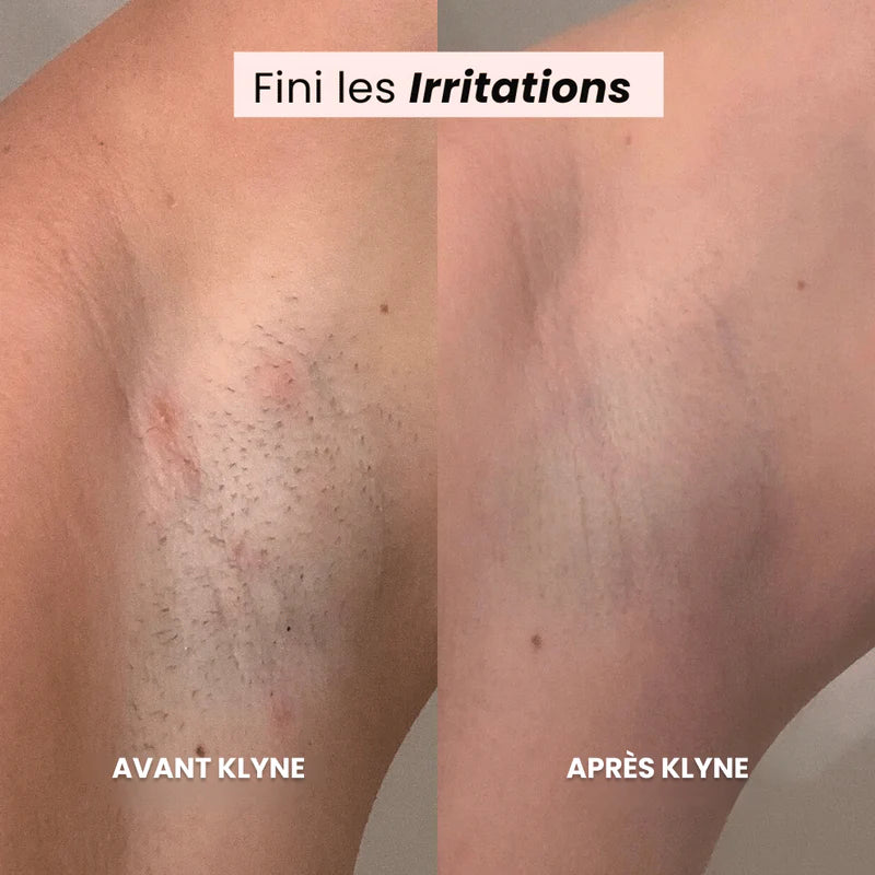 50% OFF sur le #1 rasoir 2 en 1 pour femme