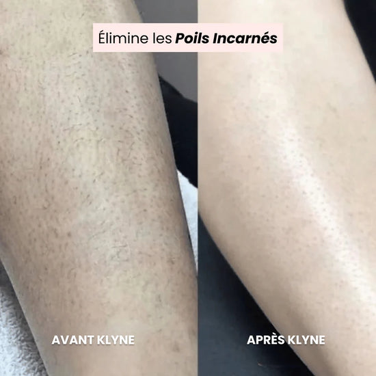 50% OFF sur le #1 rasoir 2 en 1 pour femme